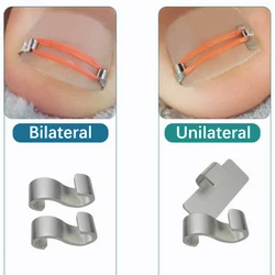 Toenail Correction Foot Care Tool Ingrown Toenail Corrector Tools Pedicure Recover Embed Toe Nail Treatment Professional