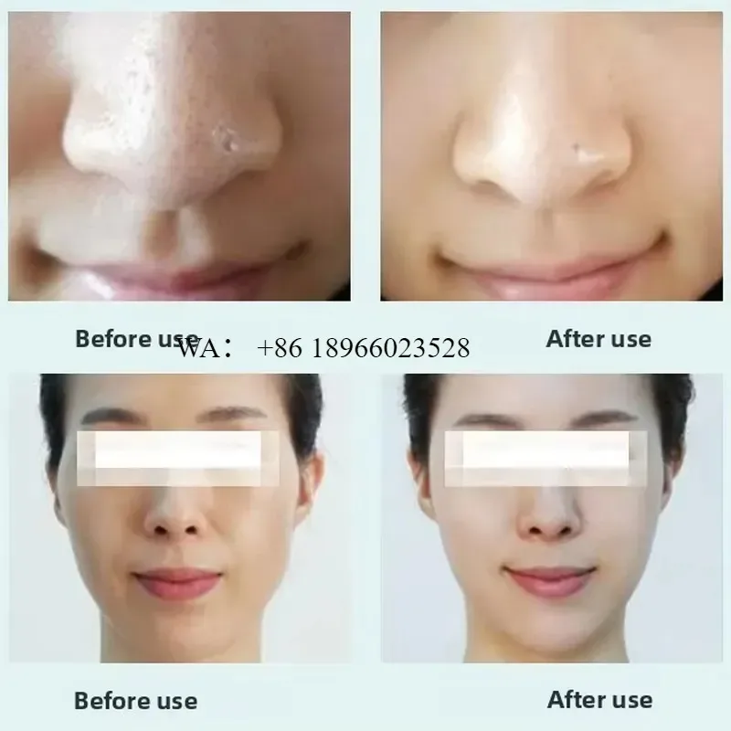 WMWMNU for Oxygen Bubble Water Facial Aquafacial Hydro Cleaning Beauty Device