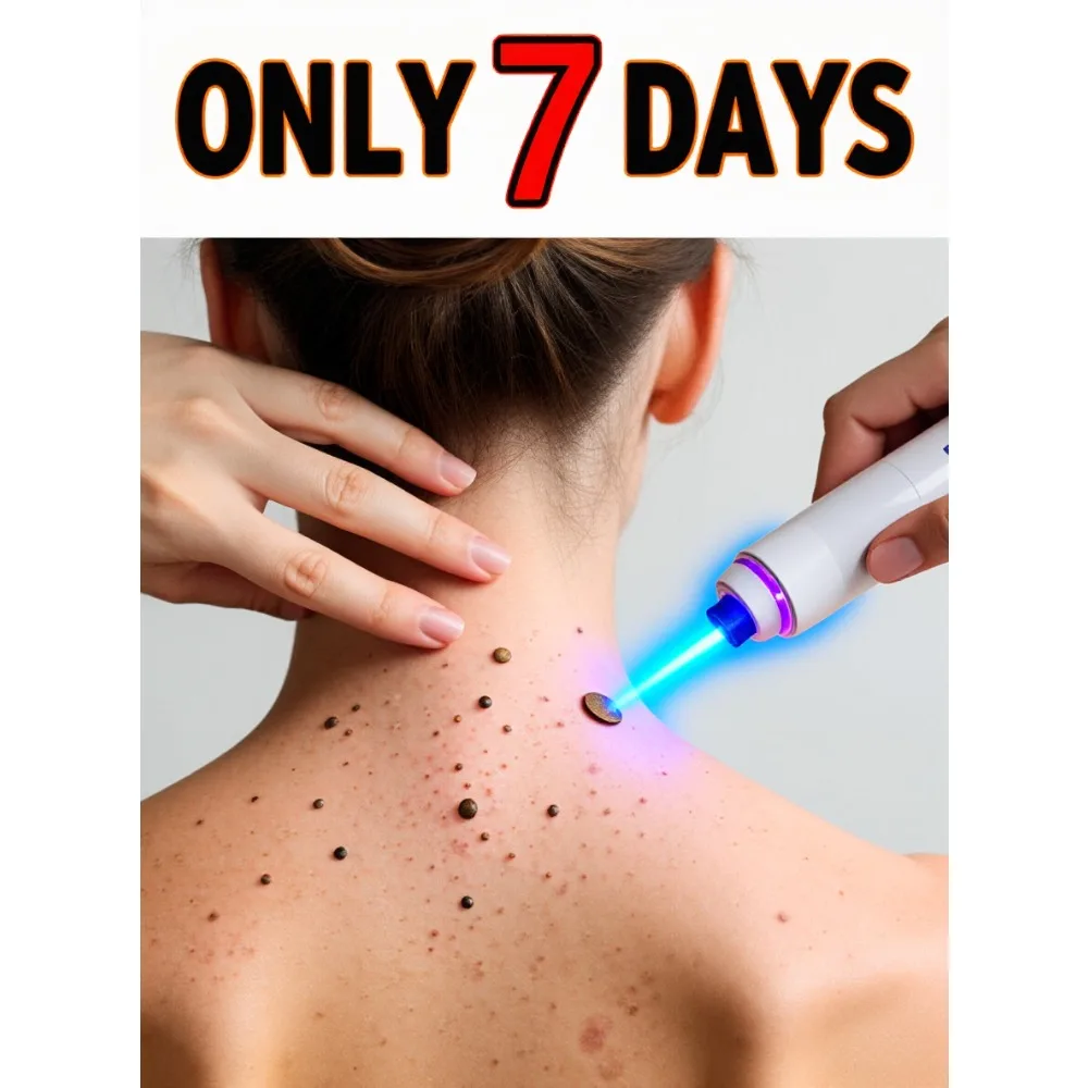 

Синий лазерный указатель 2026, абсолютно новый, для удаления бородавок, корней, быстро, обновленная версия, без забот