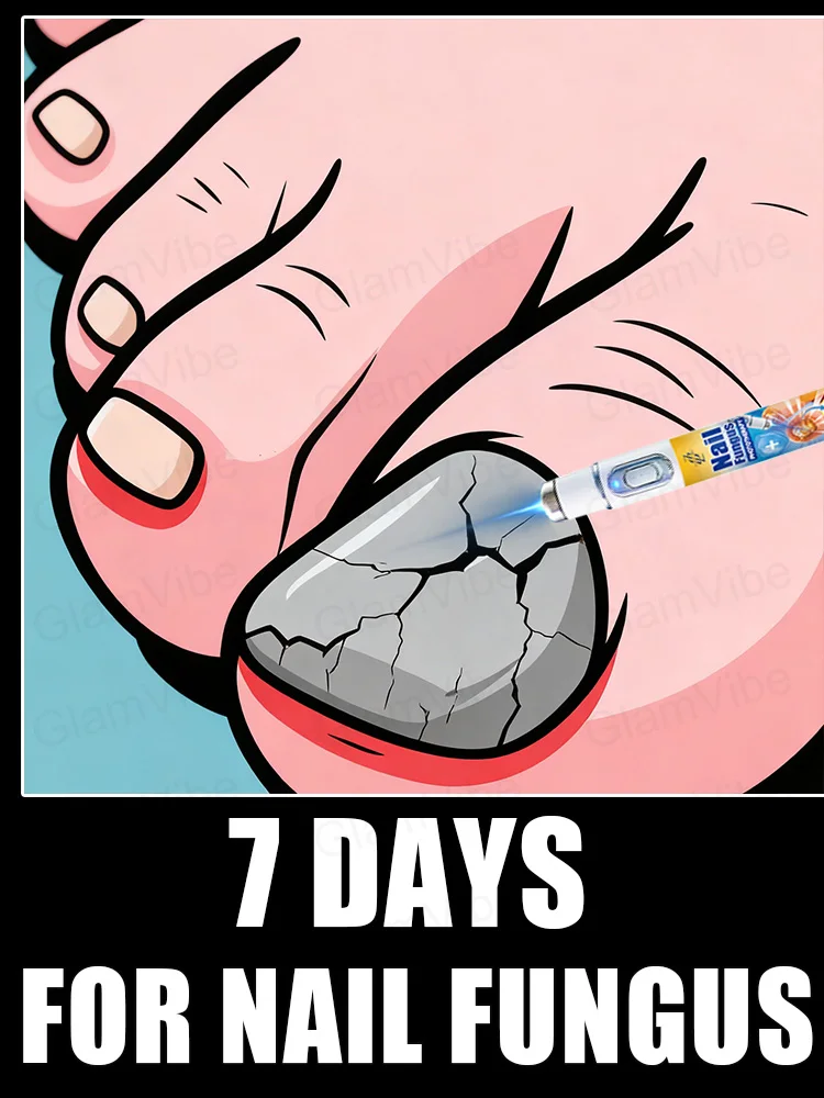 2025 Nieuwe verbeterde versie van Blue Laser Nail Fungus Treatment Tool