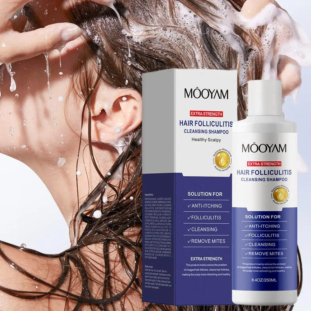 Champú antifúngico de 250 ml para folliculitis, dermatitis seborreica, psoriasis del cuero cabelludo - Calma el cuero cabelludo, alivia la picazón y la sequedad del cuero cabelludo