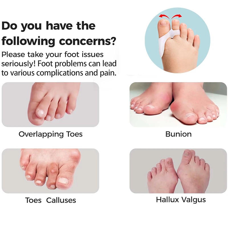 Pexmen 2/4 قطعة فواصل أصابع القدم مصحح الورم للأطفال فواصل أصابع القدم مزيلات مسامير القدم المطرقة لأصابع القدم #5