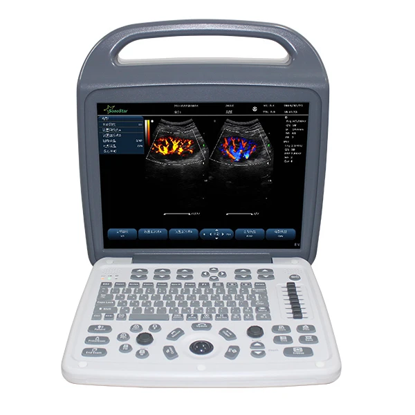 Laptop Color Doppler Ultrasound Scanner C10M