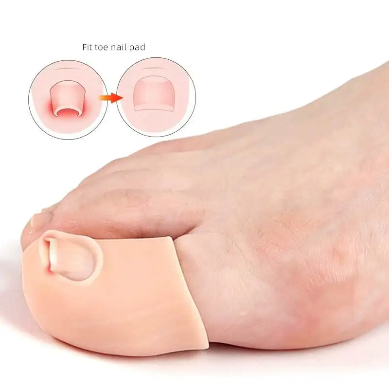 1/2Pairs Gel Ingrown Toenail Protector Cover Fingernail Toe Nail Care Anti Wear Ingrown Nail Groove Stickers Foot Care Tools