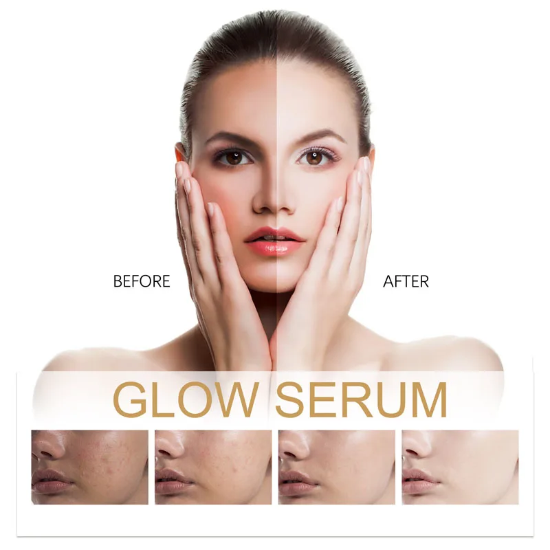 VENZEN Rejuvenating Face Cream With Niacinamide Vitamin E Deep Moisturizing Nutrition Whitening Anti-aging Face Skin Care 50g view 2