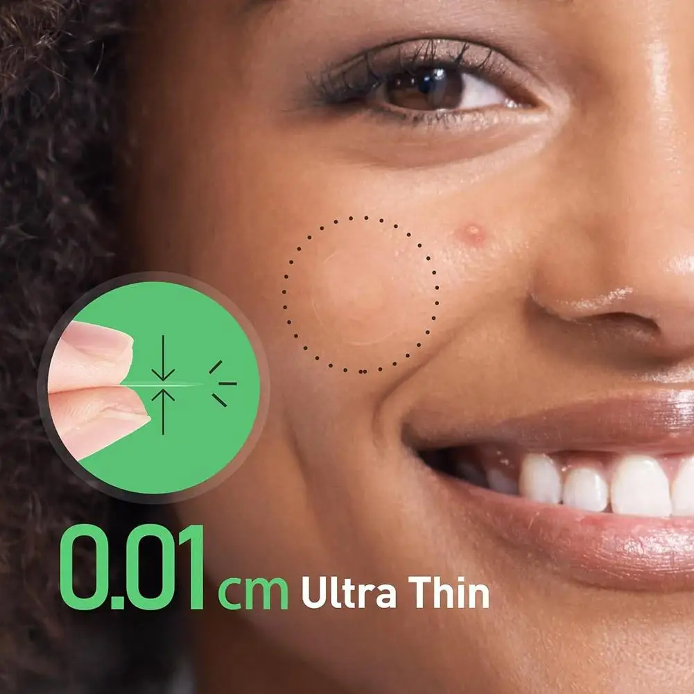 Microneedle Akne Patch Akne Entfernung Wasserdicht Glatte Concealer Unsichtbare Atmungsaktive Patch Akne Abdeckung Patches Sanfte Make-Up-Tool