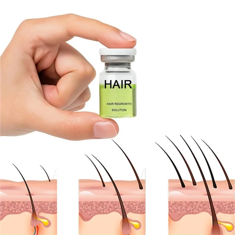 

Hair Regrowth System Hair Care Essence Balances Scalp Oil Secretion and Promotes Scalp Health and Hair Regeneration