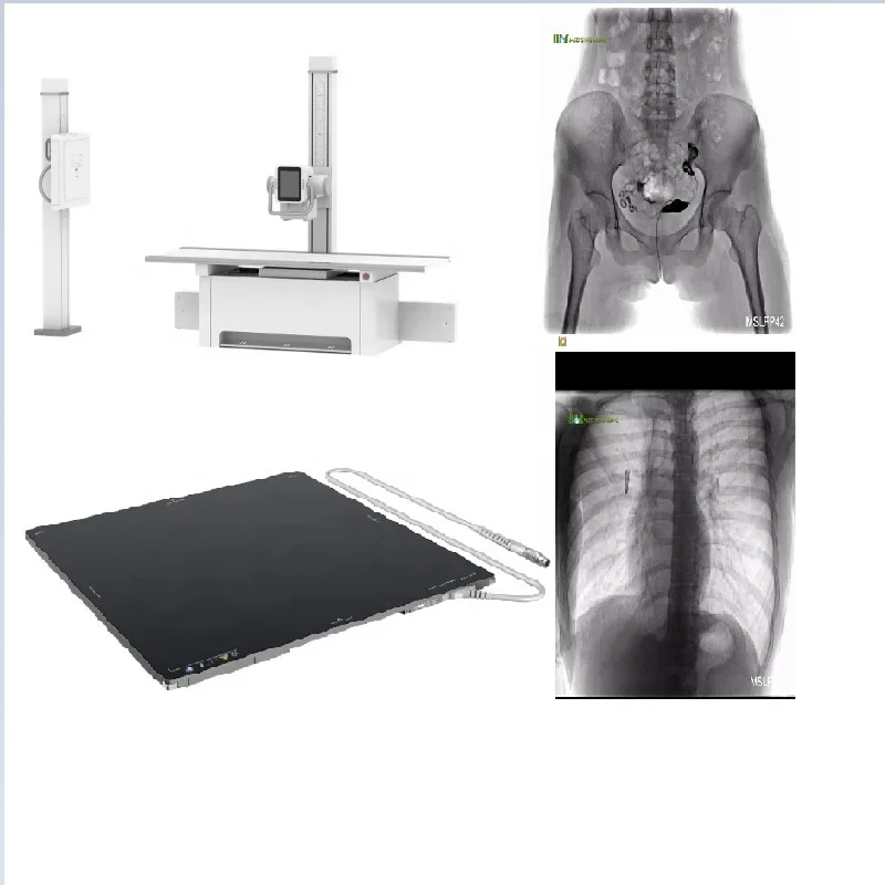 Double Column 3D X Ray Machine /50KW Radiography Imaging Diagnosis DR Xray Machine