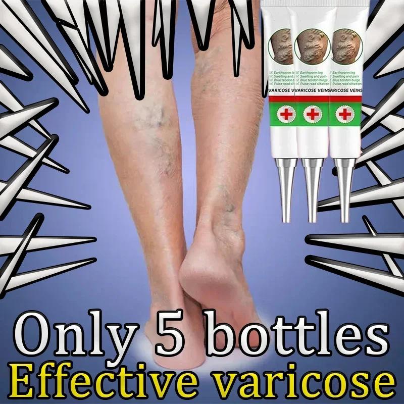 Varicose vein specific drug treatment leg swelling of earthworm blue veins raised official genuine special