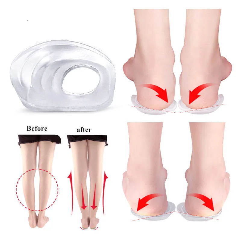 

New Orthopedic Heel Pad Insoles Men Women Shoe Inserts Cushion X-Type Leg O-Type Leg Orthopedic Pad Foot Varus Valgus Corrector