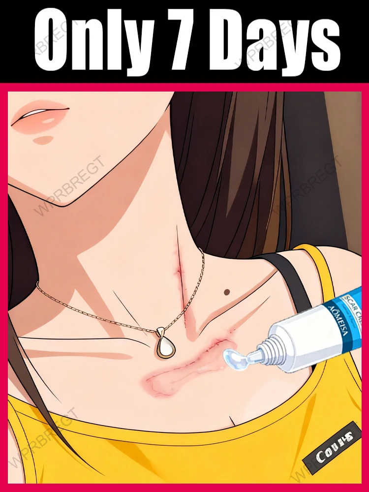 ᴴᵉʳʳᵃᵐⁱᵉⁿᵗᵃ ᵈᵉ ᵗʳᵃᵗᵃᵐⁱᵉⁿᵗᵒ ᵈᵉ ˡᵘᶻ ᵃᶻᵘˡ ᵐᵃ́ˢ ᵛᵉⁿᵈⁱᵈᵃ ᵖᵃʳᵃ ᵘⁿᵃ ʳᵃ́ᵖⁱᵈᵃ ʳᵉᵖᵃʳᵃᶜⁱᵒ́ⁿ ᵈᵉ ˡᵃ ᵖⁱᵉˡ ᑫᵘᵉ ʳᵉᵃˡᵐᵉⁿᵗᵉ ᶠᵘⁿᶜⁱᵒⁿᵃ‧