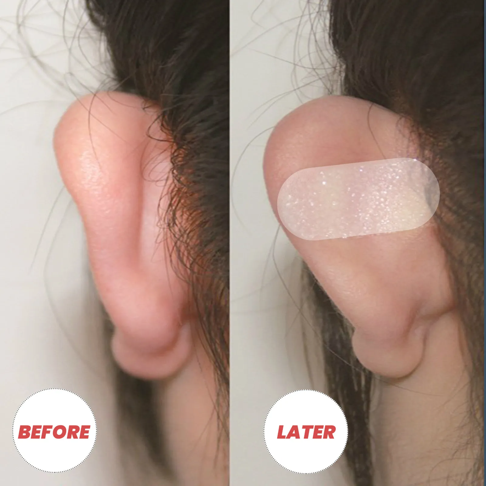 : Patch per l'orecchio