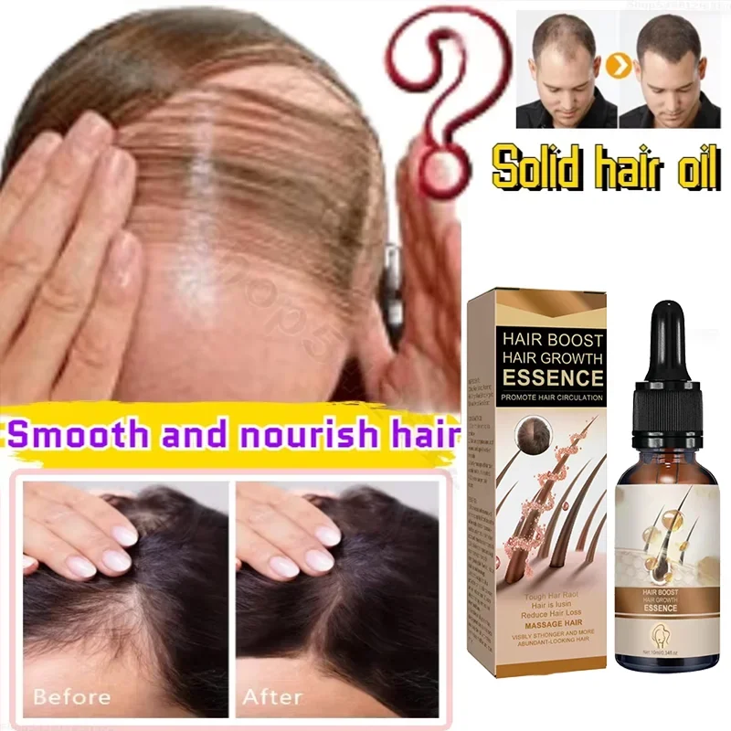 Fast Hair Growth Serum Beard Oil Axillary and Chest aHair Regrowth Fluid Longer Thicker Preventing alopecia Anti-Hair Loss