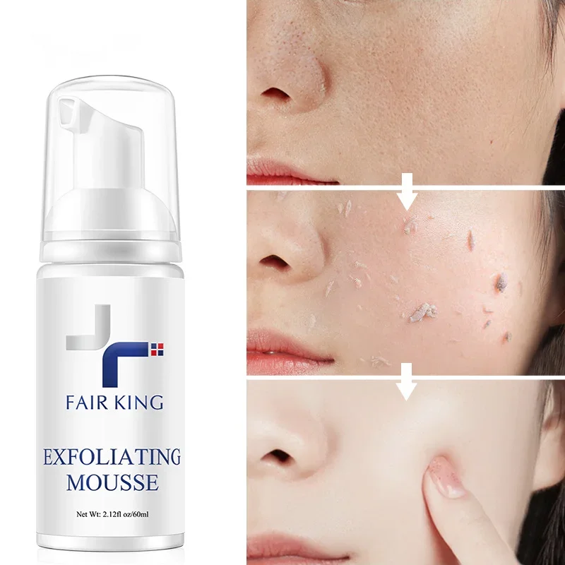 FAIR KING Exfoliating Mousse Improves Skin Texture Cleanses Makeup Dust Improves Enlarged Pores Absorbs Oil Cosmetics Wholesale