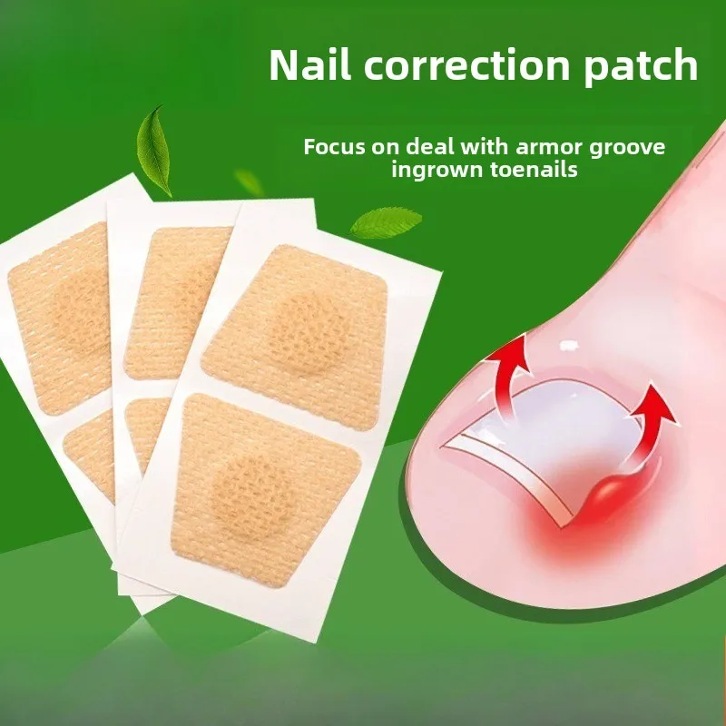 

Inserted toe nail groove relief sticker, toe roll correction sticker, manicure and orthopedic nail correction