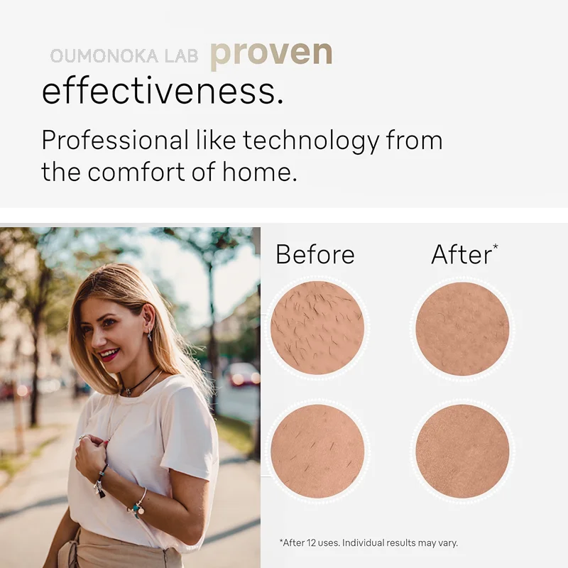 آلة إزالة الشعر بالليزر IPL الدائم للنساء آلة إزالة الشعر لحلاقة الوجه آلة قطع الشعر للرجال ماكينة حلاقة جزازة إزالة الشعر بالليزر #5