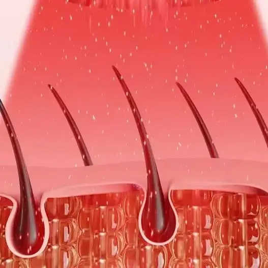 

Лазерная шапка для роста волос 96 лазеров, 650 нм, LLLT, терапия красным светом, портативный шлем для восстановления волос при облысении и улучшения здоровья кожи головы