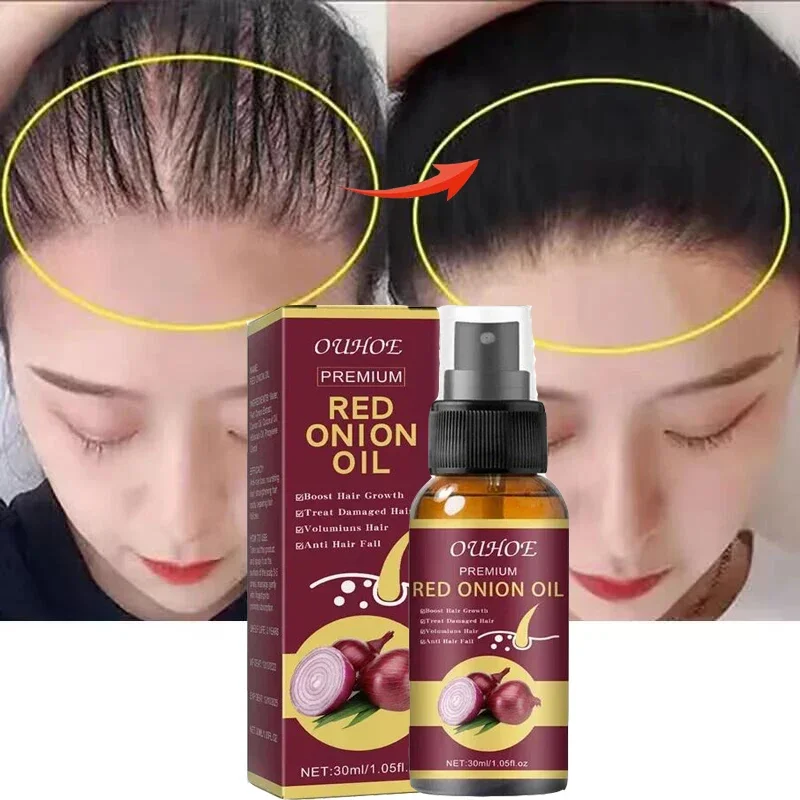 Powerful Hair Growth Serum Spray Anti Hairs Loss Treatment Product Repair Nourish Roots Regrowth Thicken Hair Care For Men Women