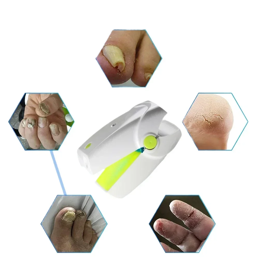 Fungal Nail Laser Device Repair Fast Nails Fungus Onychomycosis Repair Toenail Fingernail Removes Nail Fungus Foot Care Device