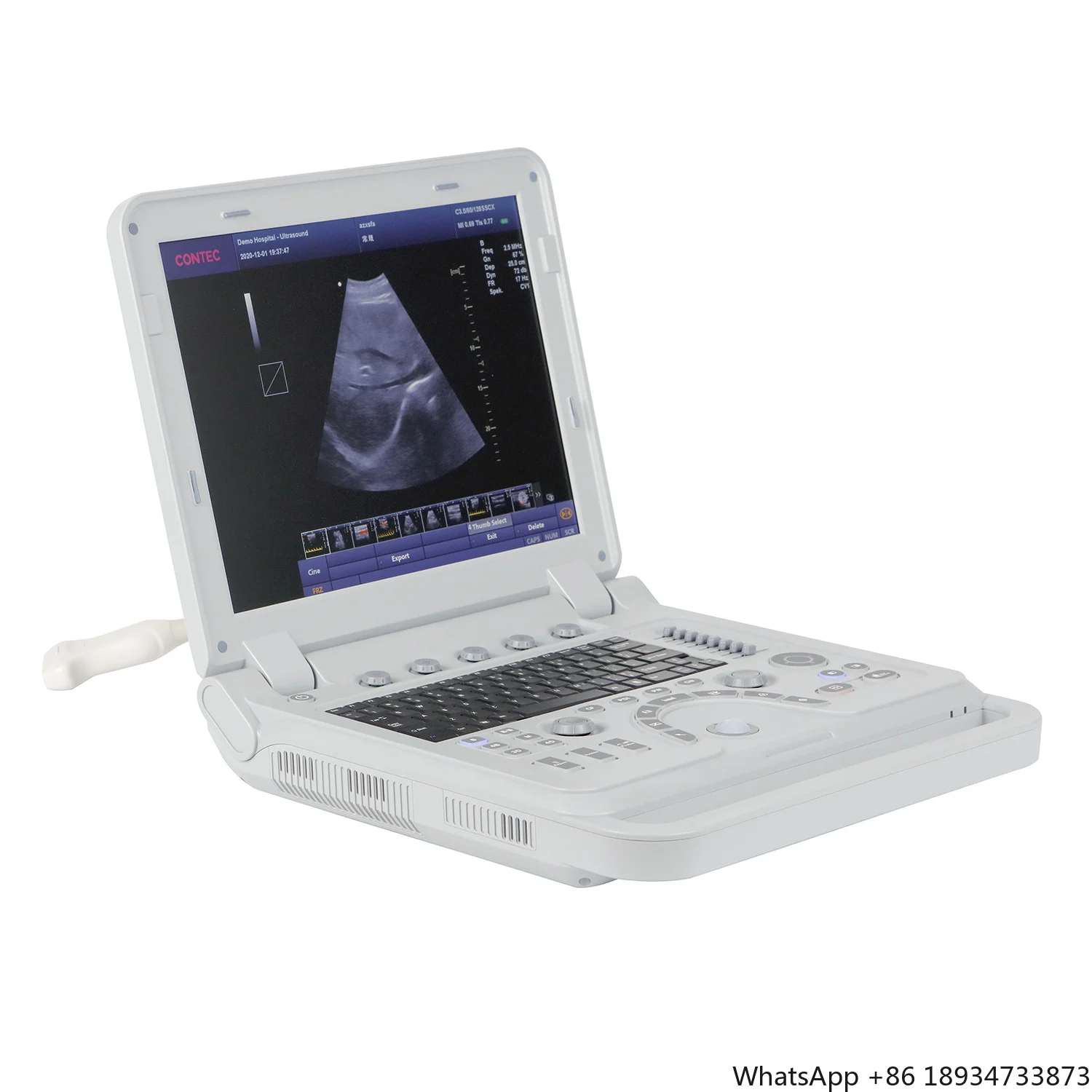 CMS1700A color doppler 4d ultrasound vascular ultrasonic doppler machine echografie toestel