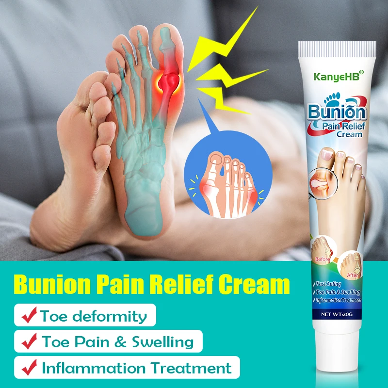 3Pcs Bunion Gout Treatment Cream Relieve Arthritis Pain Hallux Knee Lumbar Limb Stiffness Joint Valgus Corrector Ointment A990