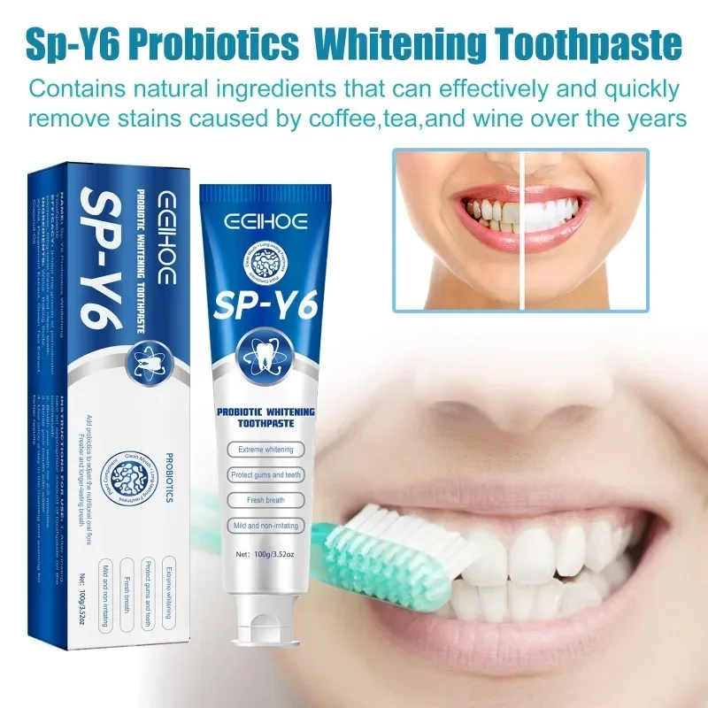 

Sdotter Probiotic Whitening Toothpaste removal Tooth Stains Fresh Breath Improve Yellow Teeth Tartar Deep Cleansing oral odor gu