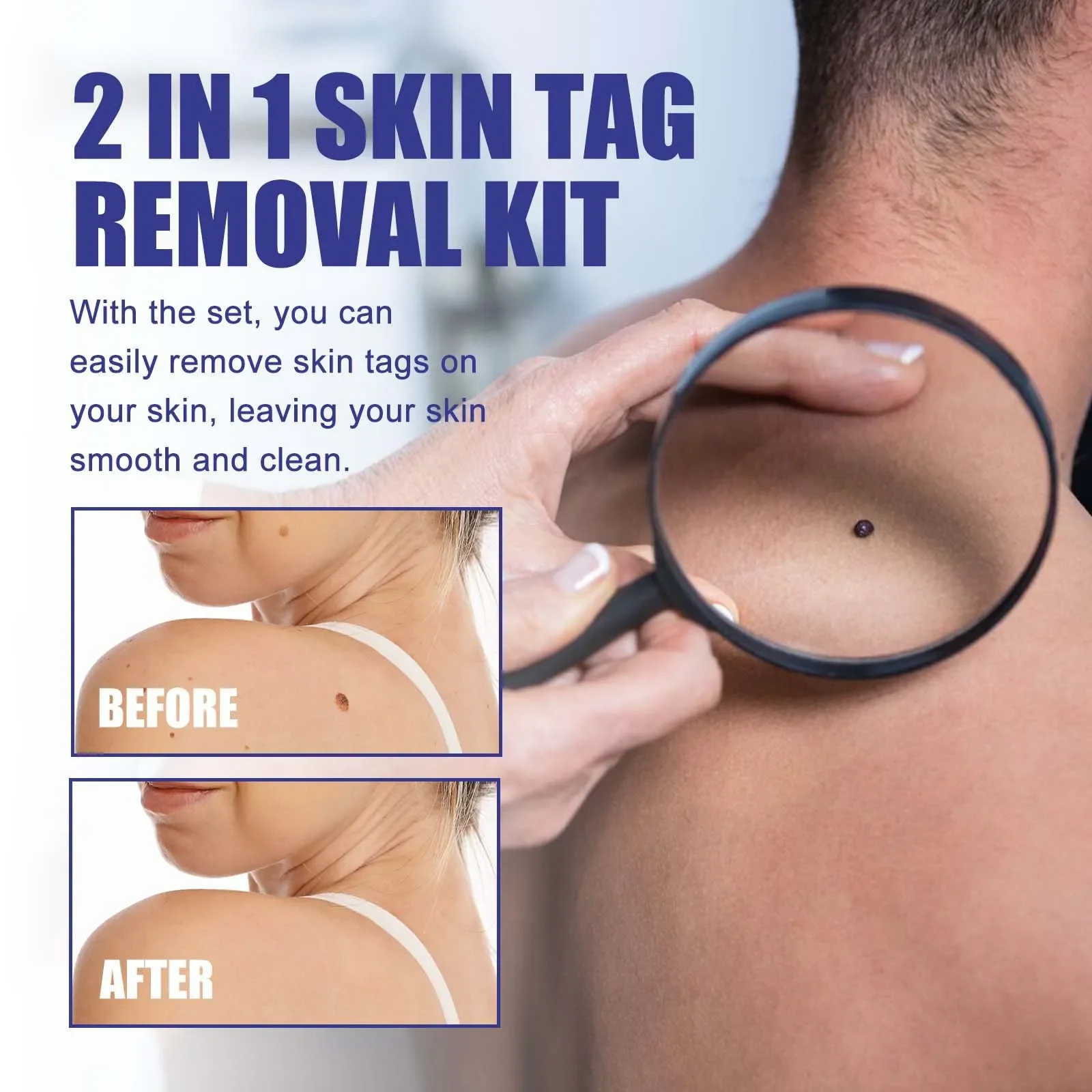 2 in1 무통증 피부 태그 점 제거 키트 클리닝 도구 얼굴 피부 관리 바디 점 치료 제거기 뷰티 헬스