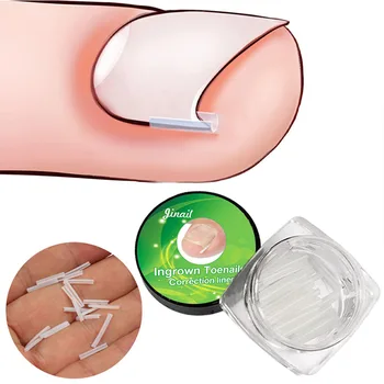 10 ピース/箱陥入爪補正 C 字型爪溝パッド切断可能な爪整形外科クリップブレース鎮痛フットケアツール