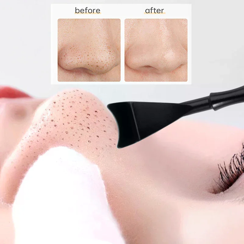 2 In 1 Pimple Popper Tool Blackhead Remover Acne Needle Removing Treatment Whitehead Popping Zit Nose Face Blemish Extractor