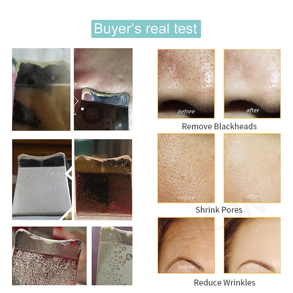 بالموجات فوق الصوتية الوجه الغسيل النقاط السوداء مزيل الرؤوس السوداء آلة تقشير الوجه بالموجات فوق الصوتية الجلد الغسيل حب الشباب المسام التنظيف العميق