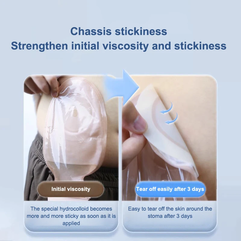 1Pcs One-piece Colostomy Bags Disposable Hydrocolloid Ostomy Drainable Single Tie Pouch For Stoma Care BagsPatella Kneecap Band