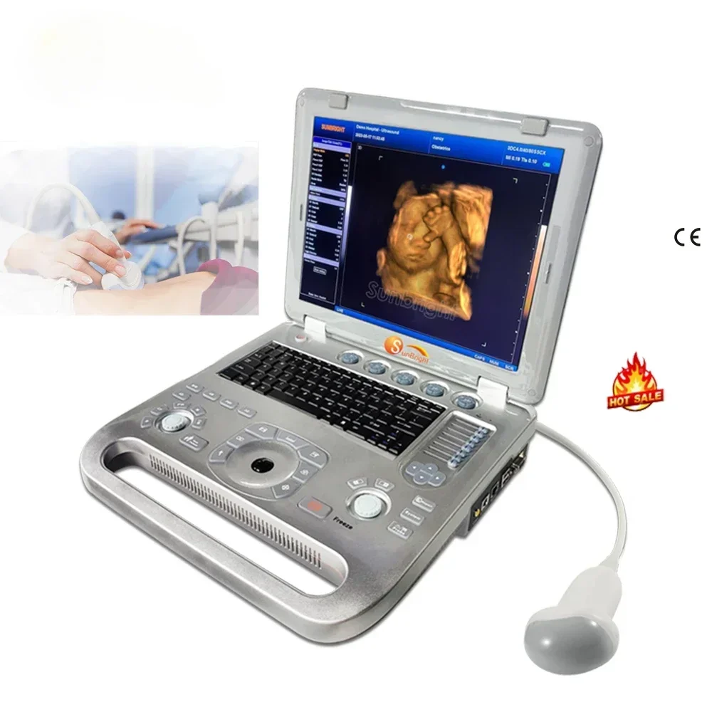 High end echocardiography portable for medical image system ultrasound gyn 2d 3d 4d Sonography