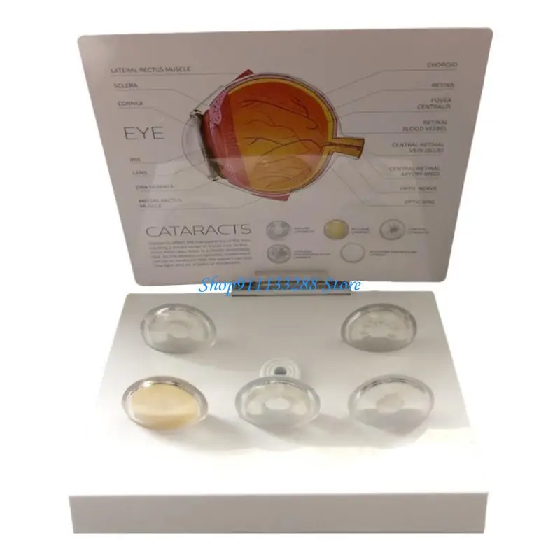 Human Anatomical Eye Model Realistic Pathological Eyeball Anatomy Model for Teaching Demonstration and Educational Use