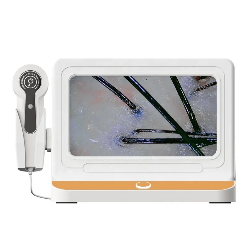 And Scalp Hair Analysis Machine hair analyzer hair scope test device