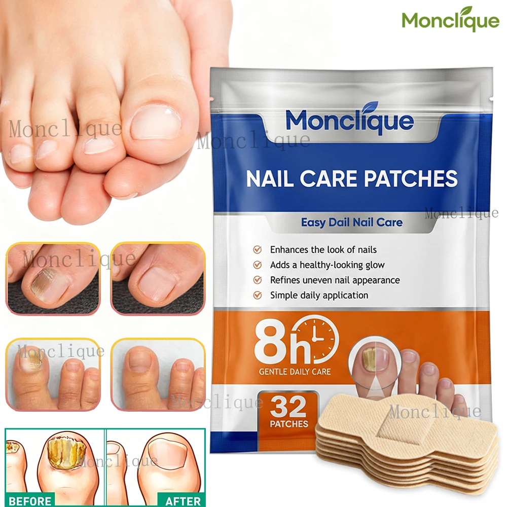 Nails Fungus Repair Patch Embedded Growth Toenails Corrective Bandage Gray Fungal Infection Discoloration Cracking Repair Care