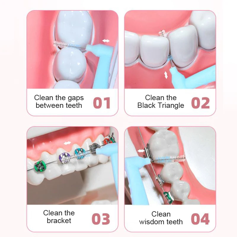 فرشاة بين الأسنان لتقويم الأسنان ، والتنظيف بين الأسنان ، ونظافة الأسنان ، والميكروفرشاة ، وفرشاة صغيرة ، و 10