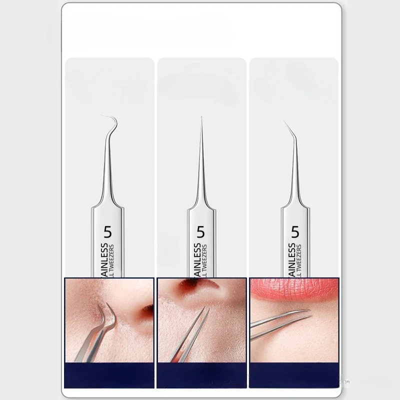 スキンケア用のにきびピンセット,顔の美しさ,にきびの除去,針ツール,極細,No。5,携帯電話,1パック