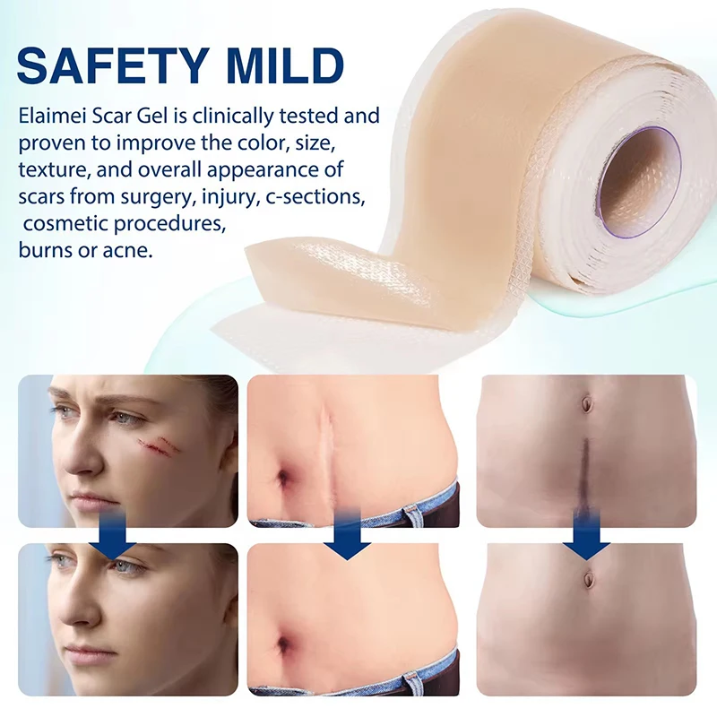 Silicone Scar Tape For Surgical Scars Medical Grade Silicone Scar Sheet Painless Effective Scar Repair Tape