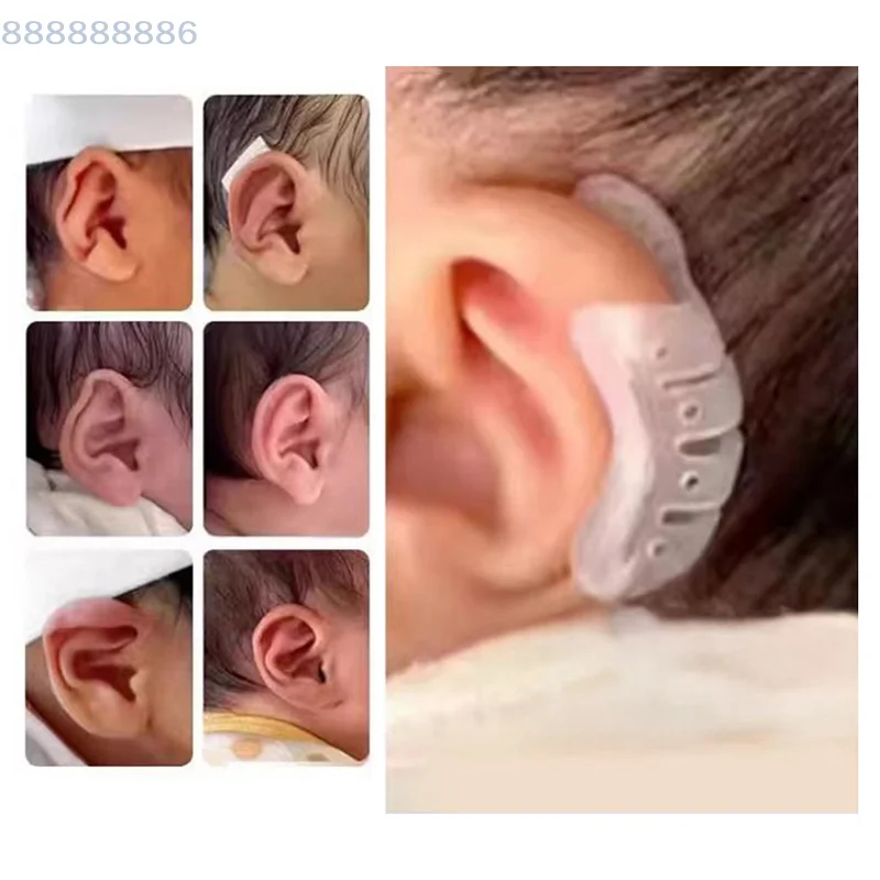 

Силиконовый детский корректор ушей, пластырь, выступающая поддержка ушей, корректор вальгусной деформации ушной раковины, инструмент для регулировки деформации ушей
