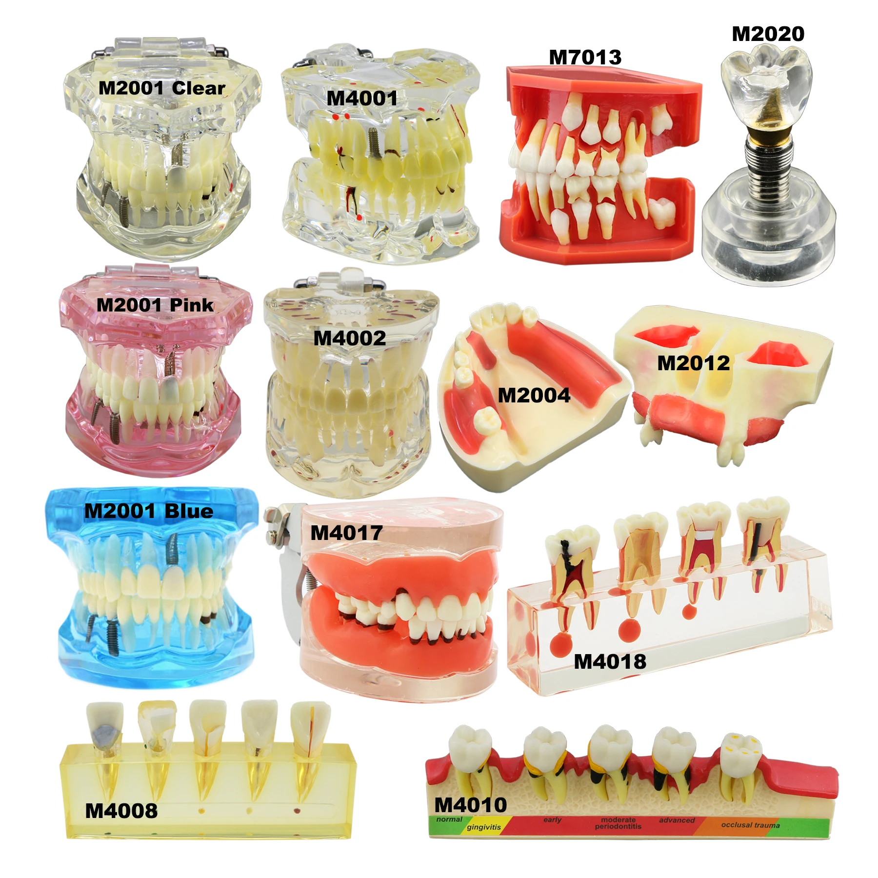 Dental Typodont Model zębów przywrócenie implantu choroba przyzębia patologia leczenie endodontyczne próchnica kanału korzeniowego Demo