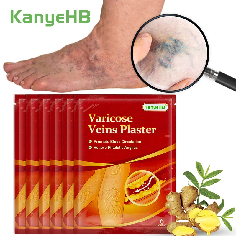 

6/12/24/36/48/60Pcs Varicose Vein Patch Vasculitis Removal Phlebitis Spider Veins Leg Chinese Herbal Medicine Veins Pain Plaster