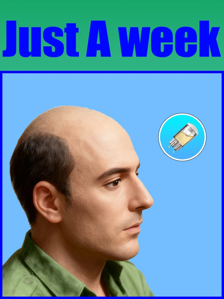 

2025Free shipping,Scalp Applicator Mini Head Massager Roller Ball Brush Hair Growth Liquid Applicator Massage Comb Combination