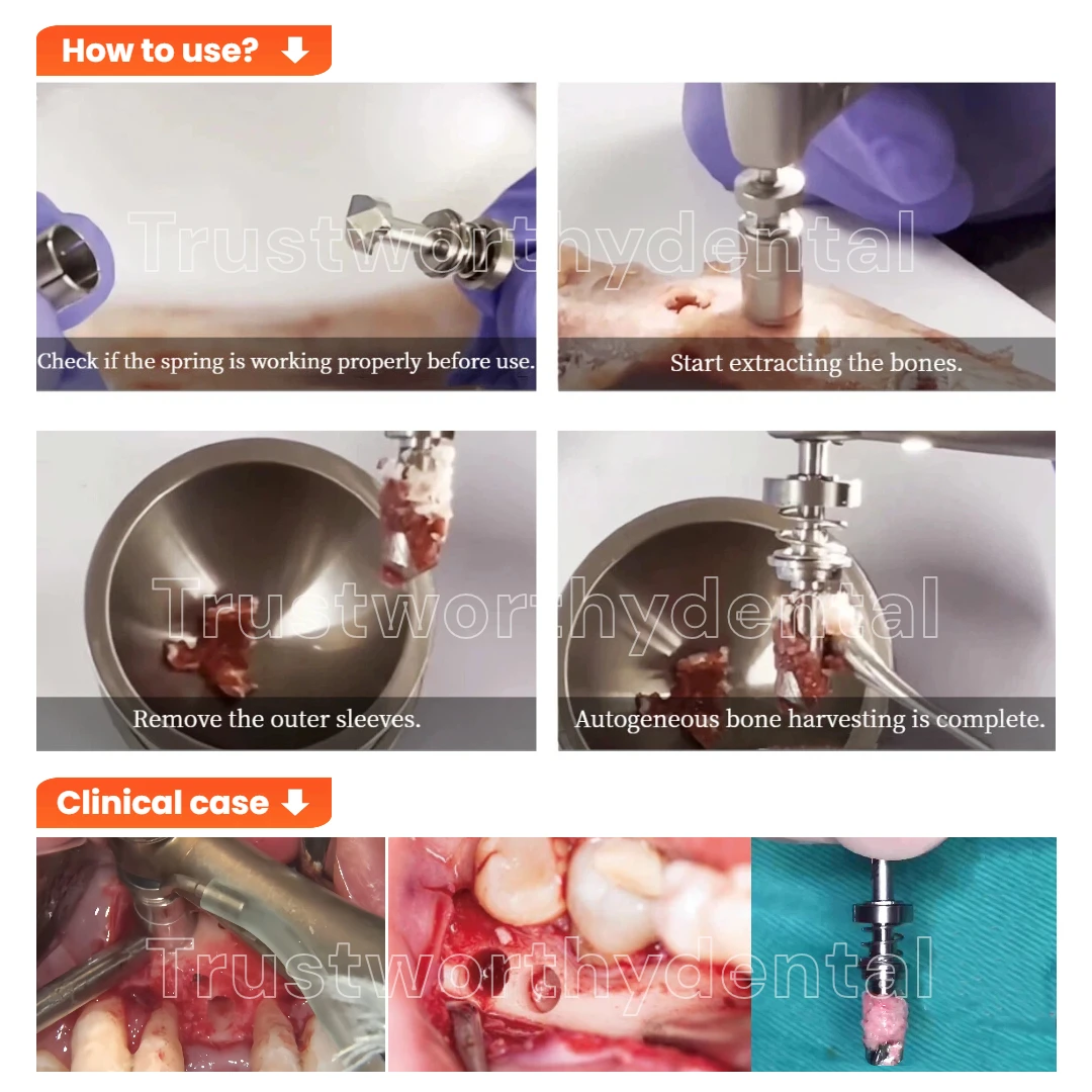 Thumbnail 2 - #51 Best Selling Dental Drills