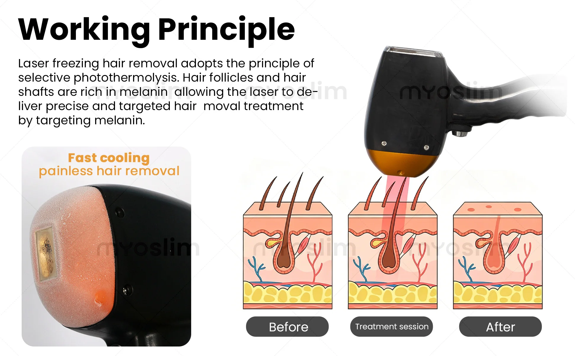 

5000W 808nm Diode Laser Hair Removal Machine 808 755 1064 Permanent Removal Cooling Head Painless Laser Epilator Salon CE