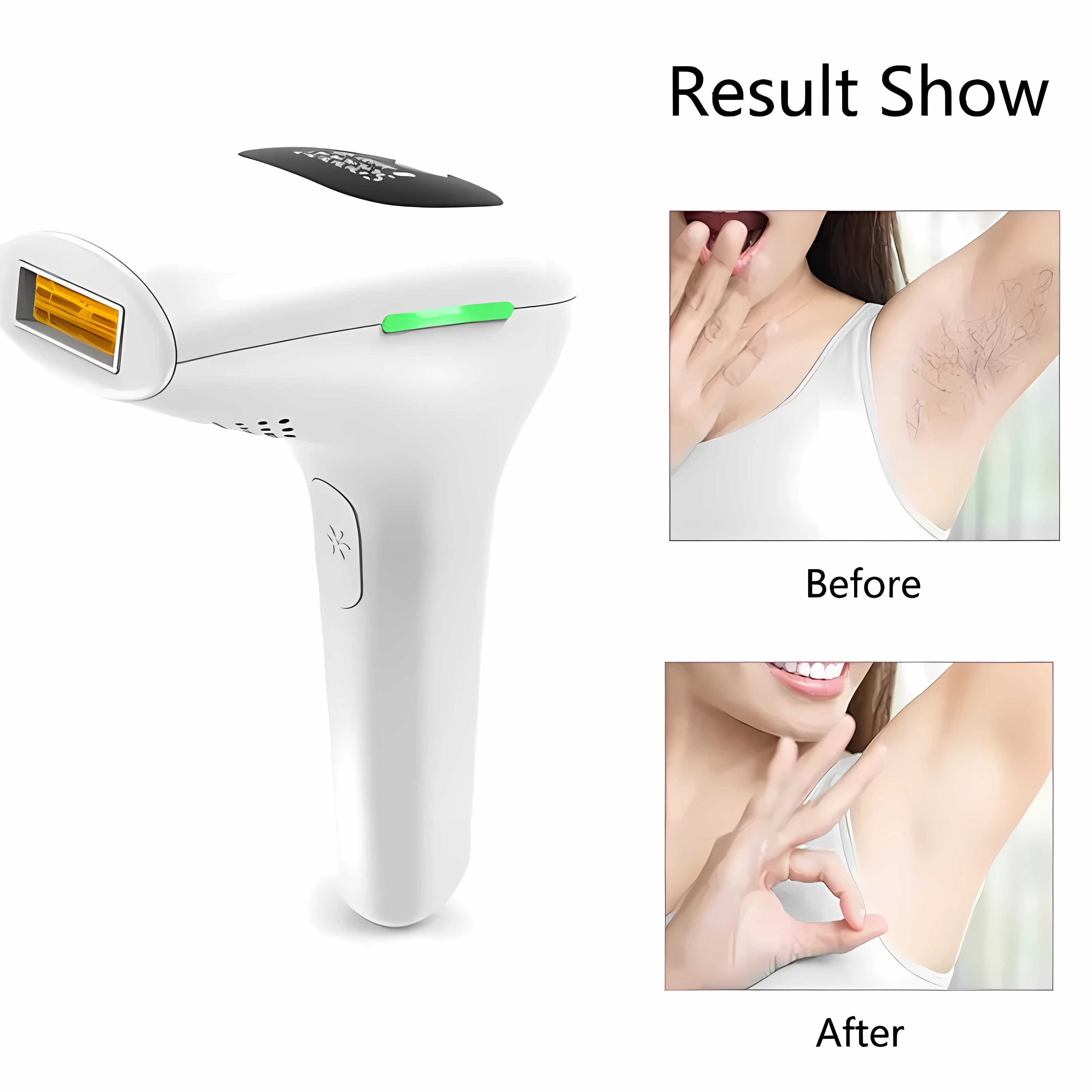 2024Professional Laser Machine Depilation Lazer Hair Removal Device Body Facial Epilator Hair Remover