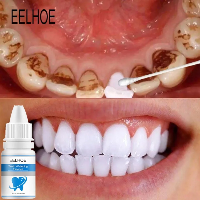 

Teeth Whitening Essence Remove Plaque Stains Improve Yellow Tooth Stain Remover Oral Hygiene Cleansing Bleaching Products