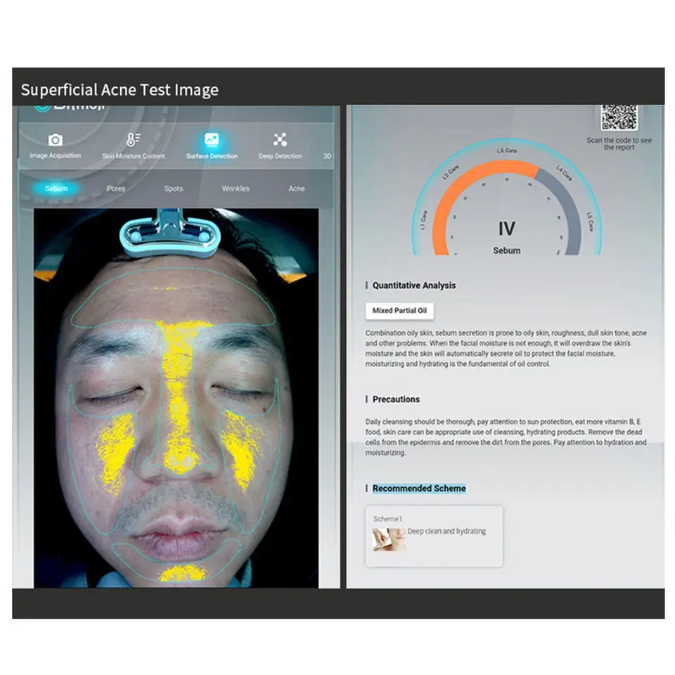 3d cuidados com a pele analisador facial monitor máquina espelho mágico vários idiomas analisador de pele 3d analisador de umidade da pele facial