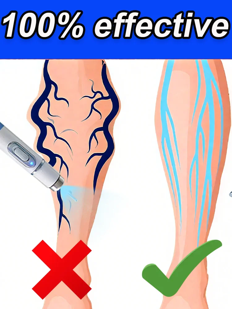 Blue light pen, body care, skin care