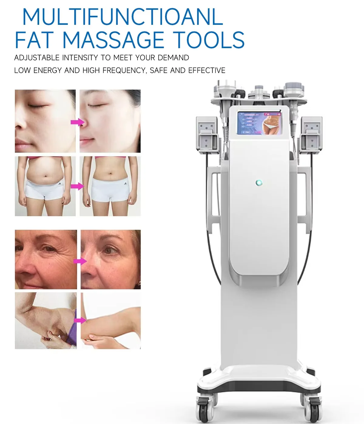 

10 в 1 кавитация 80K кавитационная вакуумная машина для похудения тела сжигание жира удаление целлюлита вакуумная машина для коррекции фигуры