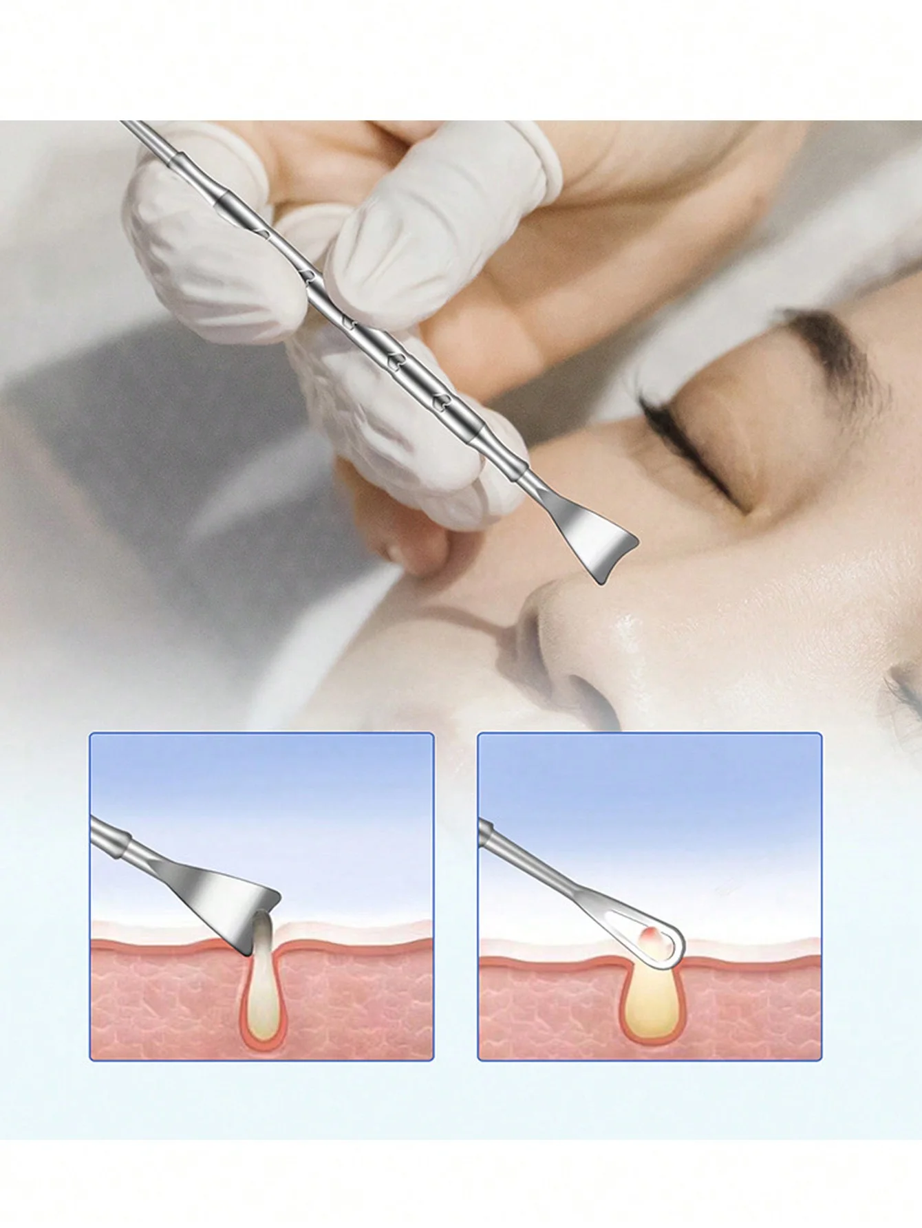 3 outils pour enlever les points noirs en acier inoxydable, aiguille d'acné à double extrémité pour nettoyer le nez, grattage des points noirs, outil de Massage et de beauté